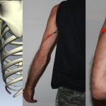 Nerve damage study: Version II, Part I